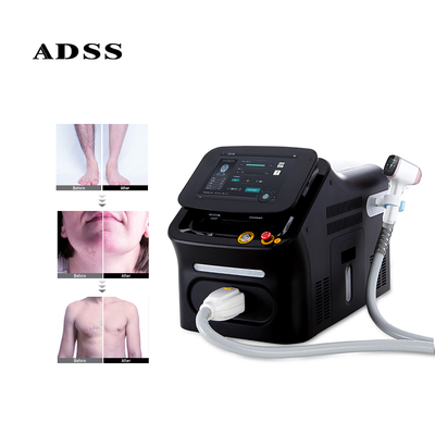 ADSS Hair Removal 808nm Diode Laser FG2000D White Switch Style Stationary Color Feature Cooling Machine Water Origin Type